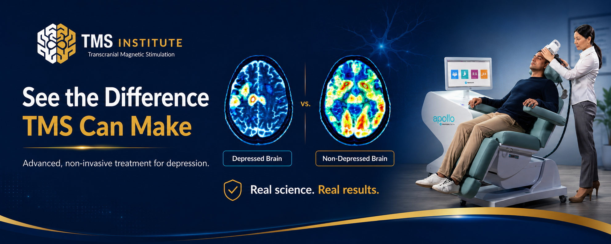 TMS Therapy: A New Hope for Depression